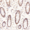 //rlrorwxhrkinln5q-static.micyjz.com/cloud/lkBpjKnjlkSRqippojmoip/91a1a6c35ddfd2056ece1bc863c042b0-60-60.jpg