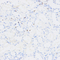 //rlrorwxhrkinln5q-static.micyjz.com/cloud/lkBpjKnjlkSRqippqjqqip/1b198ff6046e6a908c7b8045696f674a-60-60.jpg