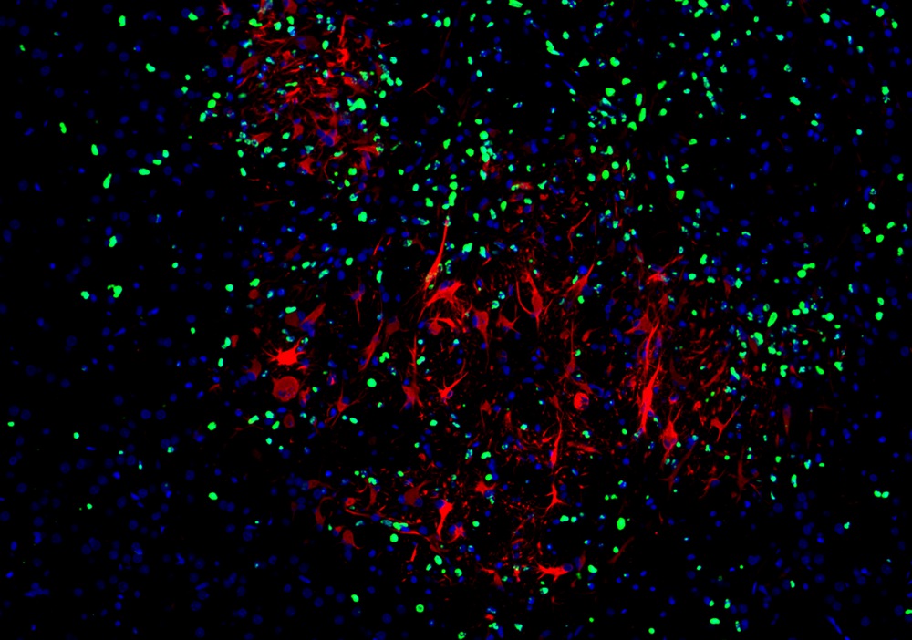 TSA Fluorescence Double Staining Kit Tyramide Signal Amplification