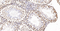 //rlrorwxhrkinln5q-static.micyjz.com/cloud/llBpjKnjlkSRqiqpqoiiiq/1605775895207256474-60-60.jpg