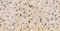 //rlrorwxhrkinln5q-static.micyjz.com/cloud/lmBpjKnjlkSRqiqpknqniq/1600764610080213681-60-60.jpg