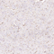 //rlrorwxhrkinln5q-static.micyjz.com/cloud/loBpjKnjlkSRqikppprniq/6a02bdc5c49b2f39bb6f08a790cecb21-60-60.jpg