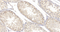 //rlrorwxhrkinln5q-static.micyjz.com/cloud/loBpjKnjlkSRqiqplkjpiq/1595311560724379864-6295-SCP1-dashugaowan-1-1300_29-6x-60-60.jpg
