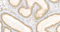 //rlrorwxhrkinln5q-static.micyjz.com/cloud/loBpjKnjlkSRqiqplkqkiq/1595308520196972774-6287-MED24-dashufugao-1-1000_25-0x-60-60.jpg