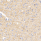 //rlrorwxhrkinln5q-static.micyjz.com/cloud/loBpjKnjlkSRqiqplonjiq/d84af42e39a86eb8a37ae3e4cae886a2-60-60.jpg