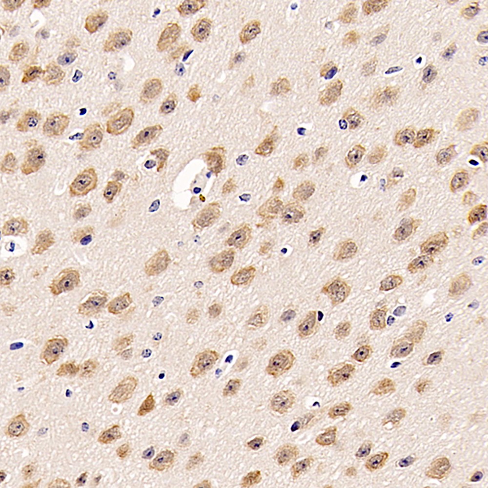 GB11138 Biological Anti NeuN Rabbit PAb From China Manufacturer gb11138-biological-anti-neun-rabbit-pab-from-china-manufacturer