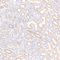 //rlrorwxhrkinln5q-static.micyjz.com/cloud/lpBpjKnjlkSRqippljjrio/8d163553c14c1d1208d5bcc2de6e1477-60-60.jpg