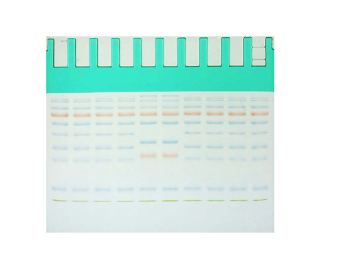 15% SDS-Page Colored Green Gel Ultra-Fast Preparation Kit