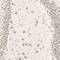 //rlrorwxhrkinln5q-static.micyjz.com/cloud/lqBpjKnjlkSRqiqpmpmjip/6e25b3c62375e34f13f0f8187b724dea-60-60.jpg